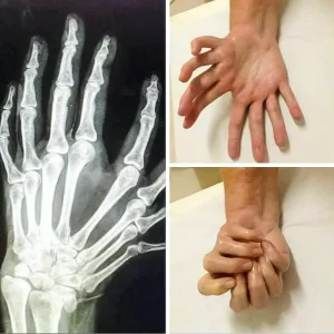 An unusual hand, 19 Photos That Look Out Of A Horror Movie